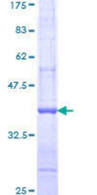 12.5% SDS-PAGE Stained with Coomassie Blue.