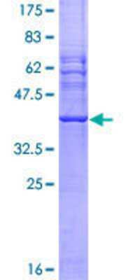 12.5% SDS-PAGE Stained with Coomassie Blue.