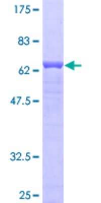 12.5% SDS-PAGE Stained with Coomassie Blue.