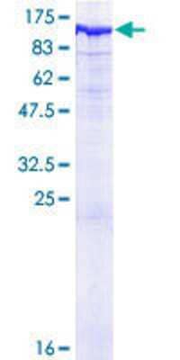12.5% SDS-PAGE Stained with Coomassie Blue.