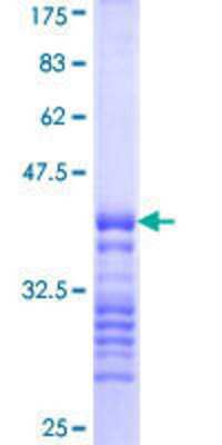 SDS-PAGE Recombinant Human IRAK2 GST (N-Term) Protein