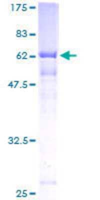 SDS-PAGE Recombinant Human IRP2 GST (N-Term) Protein