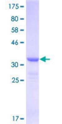 SDS-Page: Recombinant Human integrin beta 4 binding protein Protein [H00003692-Q01] - 12.5% SDS-PAGE Stained with Coomassie Blue.