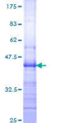 SDS-Page: Recombinant Human Integrin beta 7 Protein [H00003695-Q01] - 12.5% SDS-PAGE Stained with Coomassie Blue.