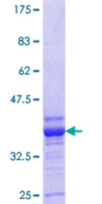 SDS-Page: Recombinant Human Kv1.1 Protein [H00003736-Q01] - 12.5% SDS-PAGE Stained with Coomassie Blue.