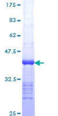 12.5% SDS-PAGE Stained with Coomassie Blue.