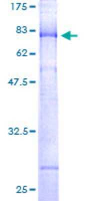 12.5% SDS-PAGE Stained with Coomassie Blue.