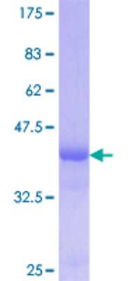 SDS-Page: Recombinant Human Kininogen GST (N-Term) Protein [H00003827-Q01] - 12.5% SDS-PAGE Stained with Coomassie Blue.