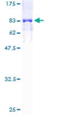 SDS-PAGE Recombinant Human Cytokeratin 6b GST (N-Term) Protein