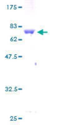 Other Recombinant Human KRTHA3B GST (N-Term) Protein