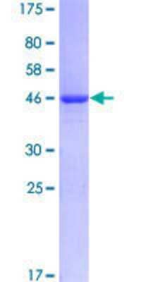 12.5% SDS-PAGE Stained with Coomassie Blue.