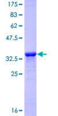 12.5% SDS-PAGE Stained with Coomassie Blue.