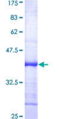 SDS-Page: Recombinant Human DNA Ligase IV Protein [H00003981-Q01] - 12.5% SDS-PAGE Stained with Coomassie Blue.