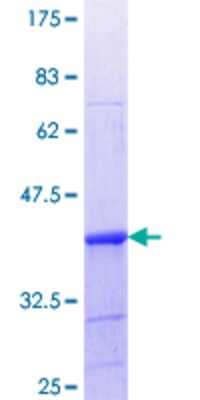 12.5% SDS-PAGE Stained with Coomassie Blue.