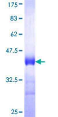 SDS-Page: Recombinant Human MARCKS Protein [H00004082-Q01] - 12.5% SDS-PAGE Stained with Coomassie Blue.