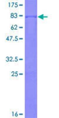 12.5% SDS-PAGE Stained with Coomassie Blue.