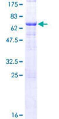 12.5% SDS-PAGE Stained with Coomassie Blue.