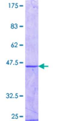 12.5% SDS-PAGE Stained with Coomassie Blue.