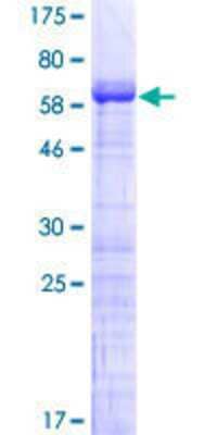 12.5% SDS-PAGE Stained with Coomassie Blue.