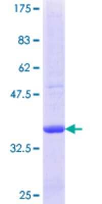 12.5% SDS-PAGE Stained with Coomassie Blue.