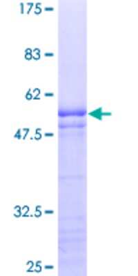 12.5% SDS-PAGE Stained with Coomassie Blue.