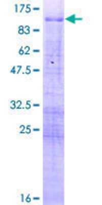 12.5% SDS-PAGE Stained with Coomassie Blue.