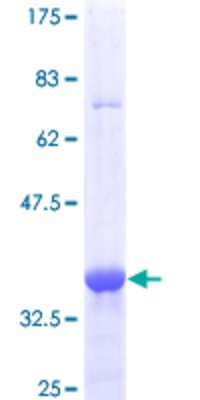 SDS-Page: Recombinant Human MBD1 Protein [H00004152-Q01] - 12.5% SDS-PAGE Stained with Coomassie Blue.