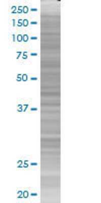MBD1 transfected lysate.