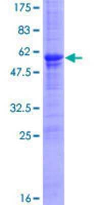 12.5% SDS-PAGE Stained with Coomassie Blue.