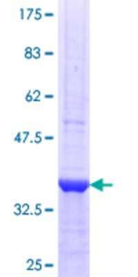 12.5% SDS-PAGE Stained with Coomassie Blue.