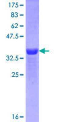 12.5% SDS-PAGE Stained with Coomassie Blue.