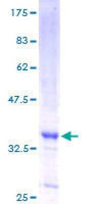 12.5% SDS-PAGE Stained with Coomassie Blue.