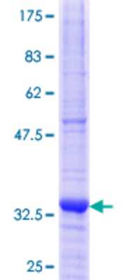 12.5% SDS-PAGE Stained with Coomassie Blue.