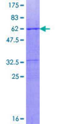 12.5% SDS-PAGE Stained with Coomassie Blue.