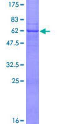 12.5% SDS-PAGE Stained with Coomassie Blue.