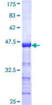 SDS-Page: Recombinant Human CIITA Protein [H00004261-Q01] - 12.5% SDS-PAGE Stained with Coomassie Blue.