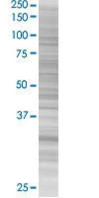 MLLT6 transfected lysate.