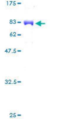 12.5% SDS-PAGE Stained with Coomassie Blue.