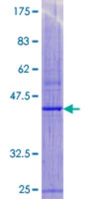 SDS-Page: Recombinant Human MPV17 Protein [H00004358-P01] - 12.5% SDS-PAGE Stained with Coomassie Blue.