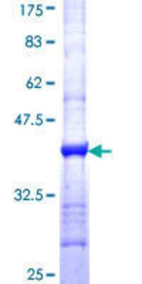 12.5% SDS-PAGE Stained with Coomassie Blue.