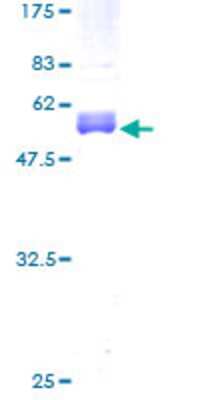 12.5% SDS-PAGE Stained with Coomassie Blue.