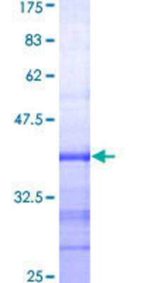SDS-Page: Recombinant Human MSH5 Protein [H00004439-Q01] - 12.5% SDS-PAGE Stained with Coomassie Blue.