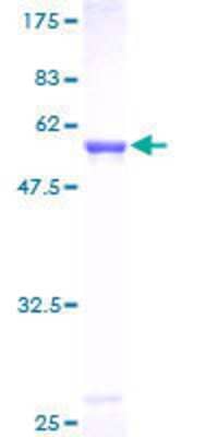 SDS-Page: Recombinant Human MTAP Protein [H00004507-P01] - 12.5% SDS-PAGE Stained with Coomassie Blue.