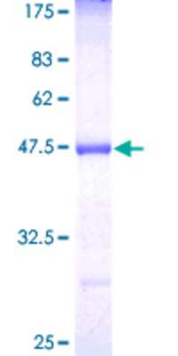 12.5% SDS-PAGE Stained with Coomassie Blue.