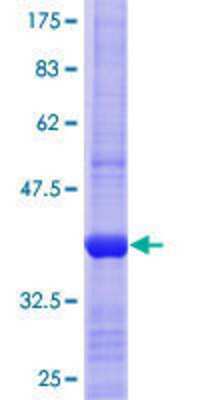 SDS-Page: Recombinant Human MTAP Protein [H00004507-Q01] - 12.5% SDS-PAGE Stained with Coomassie Blue.