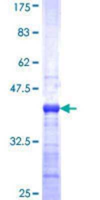 SDS-PAGE Recombinant Human MUC7 GST (N-Term) Protein