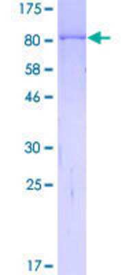 SDS-Page: Recombinant Human MYBPH Protein [H00004608-P01] - 12.5% SDS-PAGE Stained with Coomassie Blue.