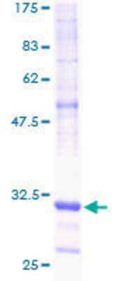 12.5% SDS-PAGE Stained with Coomassie Blue.