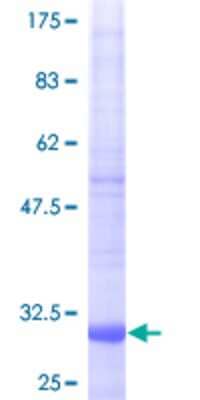 SDS-Page: Recombinant Human NDUFA1 Protein [H00004694-P02] - 12.5% SDS-PAGE Stained with Coomassie Blue.