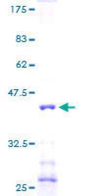 12.5% SDS-PAGE Stained with Coomassie Blue.